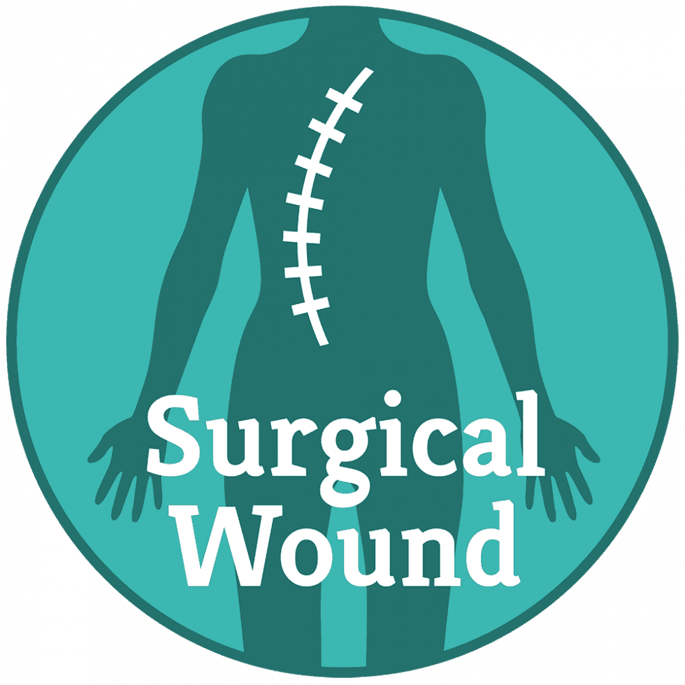 Wound Care National Wound Care Strategy Programme